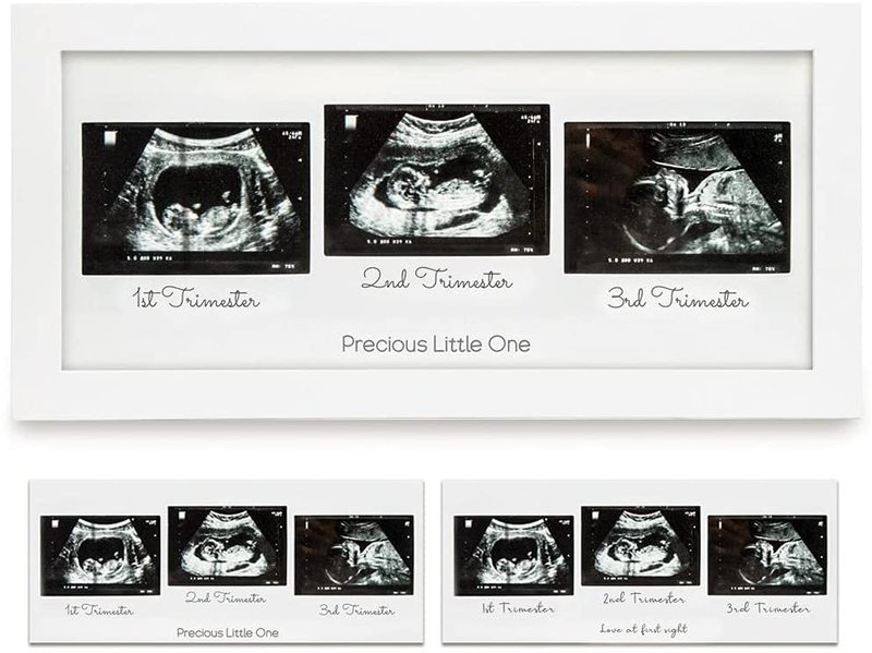Pregnancy essentials sonogram photo frame