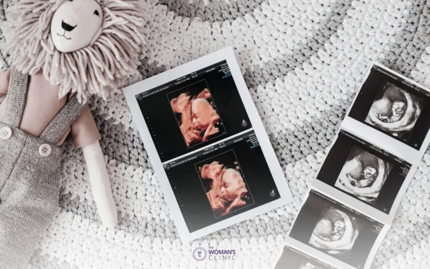 Pregnant woman holding belly during ultrasound gender determination appointment